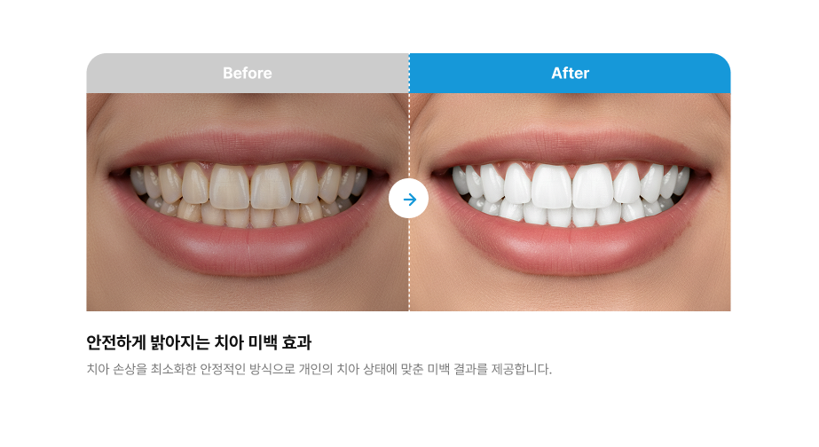 시술 전·후 비교